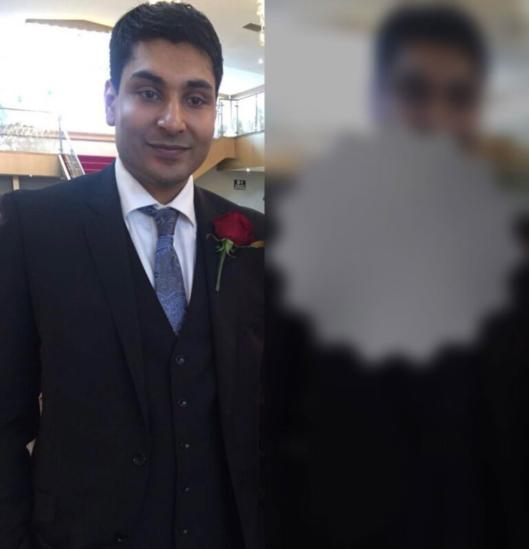 A side by side image of Kaleem - the legally blind guy - illustrating the symptoms of CRD. In the elft hand side, Kaleem wears a 3-piece suit with a flower on his suit lapel. You can see the photo in detail including the lapel flower, the buttons on Kaleem's suit and the background of the building and the blue sky. On the right hand side is the same image. However there is a big roundish blind point obsuring at least 60% of the image. In addition, the portions of the picture which are not obscured by the blind spot are extremely blury and undetailled. Eg.. on a side by side review, in the left hand photo you can see the buttons at the bottom of Kaleem's suit and all of the details. In the right hand side all you can see is the dark colour of the suit. Similarly, in the right hand picture you can see Kaleem's facial features in full, but in the right hand picture the part of the Kaleem's face which is not obscured by the central blind spot is undetailled and you cannot see his eyes or hairstyle or any specific details. All you can see is the fact that Kaleem has brown skin and dark hair. The background is not very clear and there is a noticable lack of colour distinguishment in the right hand phot.